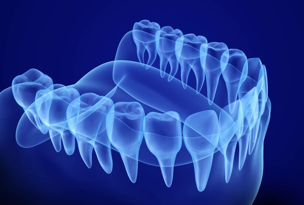 What is a 3D Dental Scan?