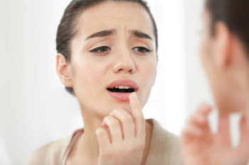 Canker Sore Causes, Treatment and Prevention
