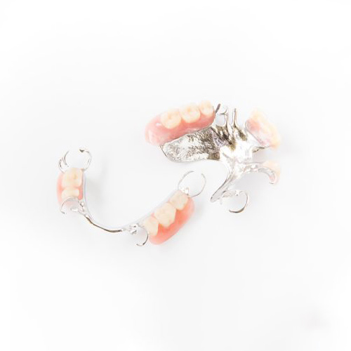 Two partial dentures side by side