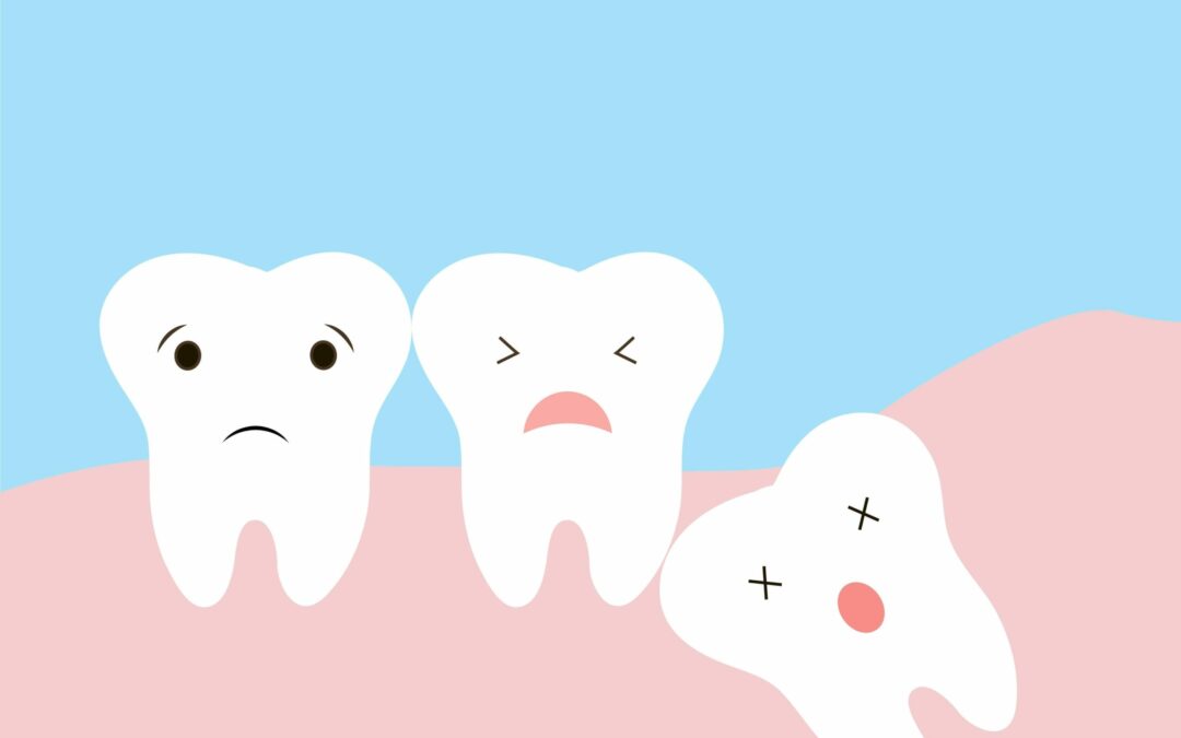 Wisdom Teeth and Your Dental Health