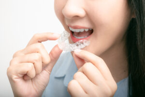 SureSmile Clear Aligners West Chester